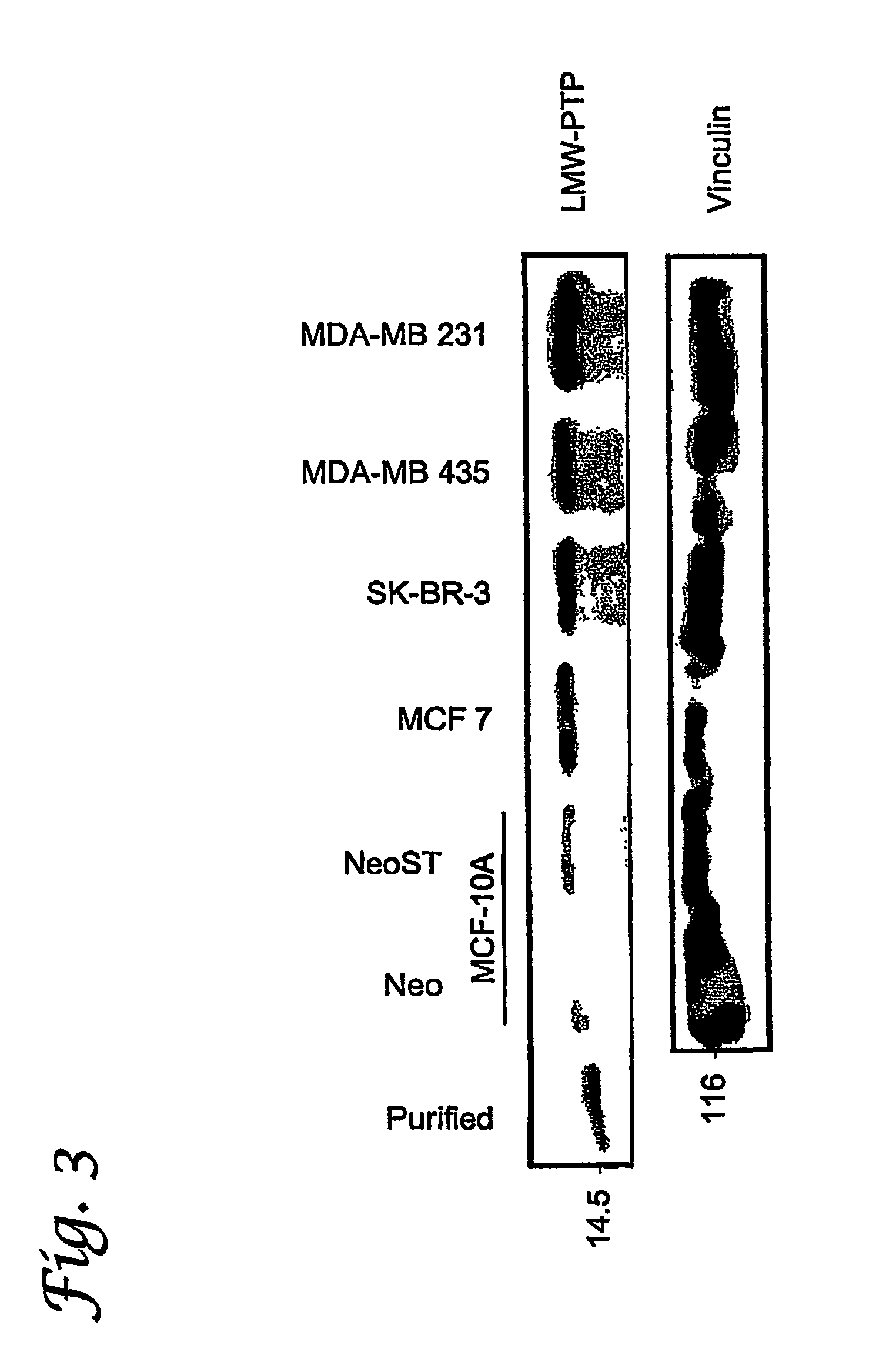 Low molecular weight protein tyrosine phosphatase (LMW-PTP) as a diagnostic and therapeutic target