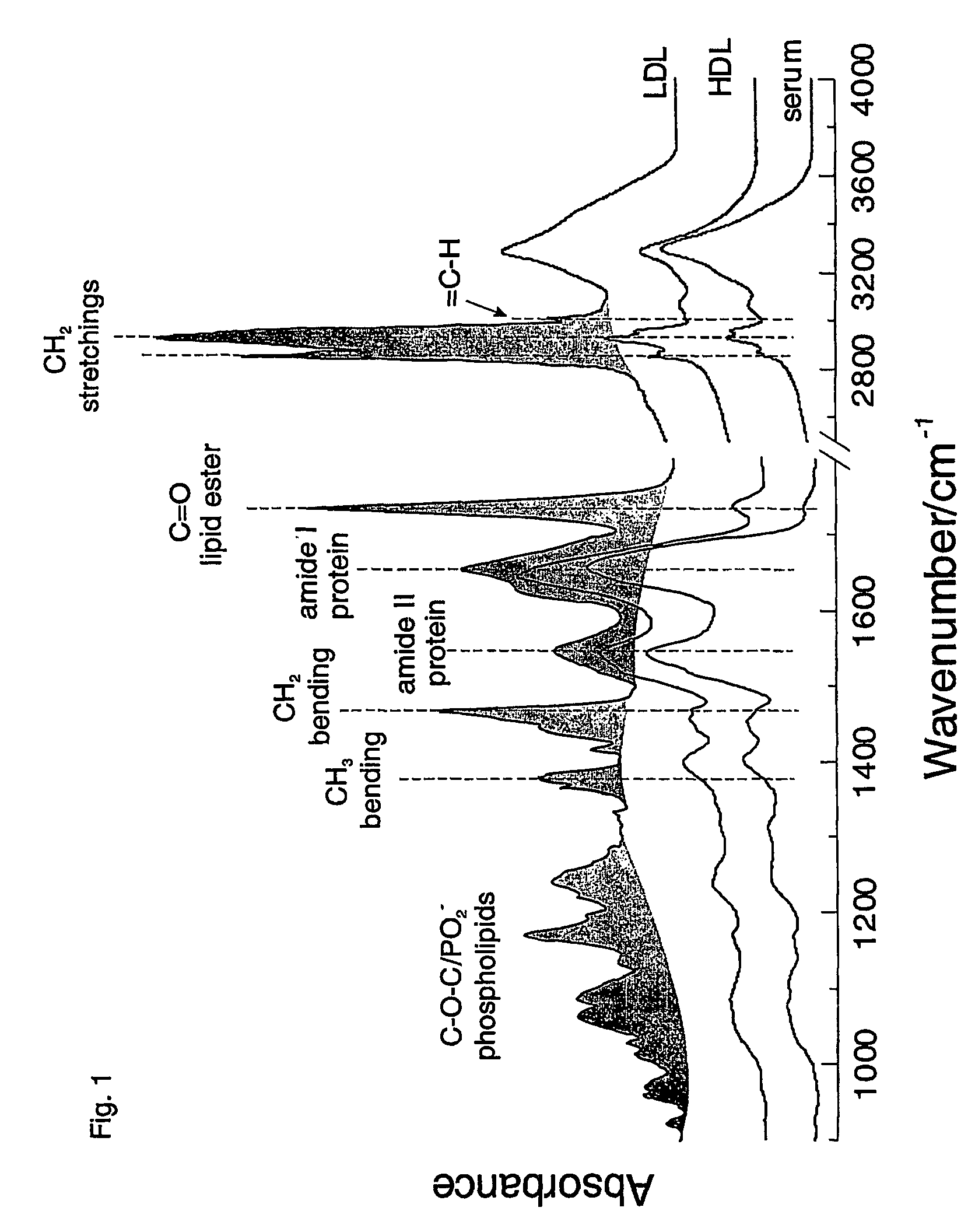 Method for the simultaneous and direct determination of serum cholesterol in high and low density lipoproteins using infrared spectroscopy