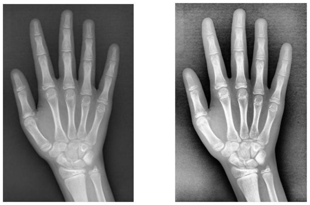 Bone age evaluation method and device based on deep convolutional neural network and feature fusion, and computer readable storage medium