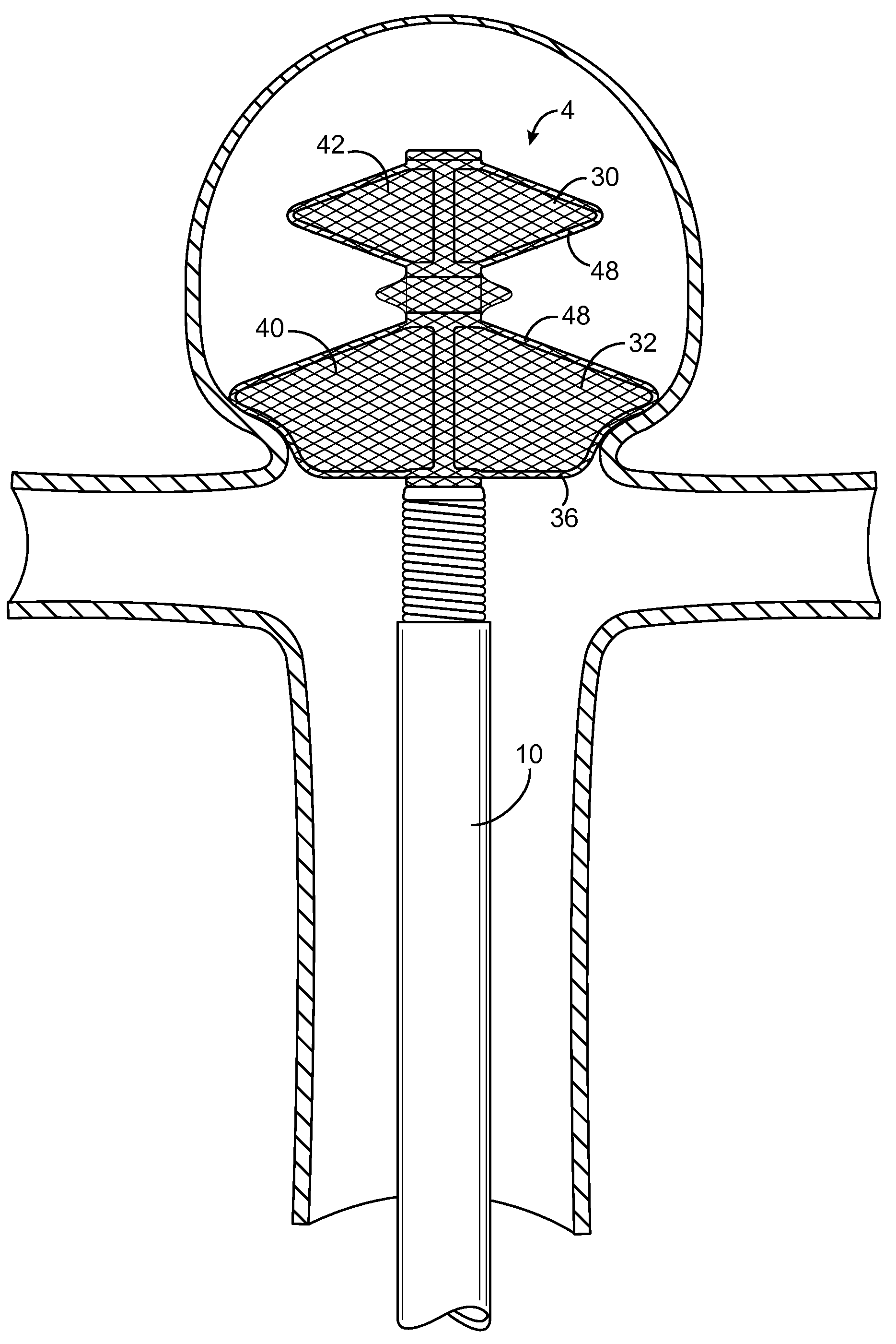 Devices and methods for treating vascular malformations