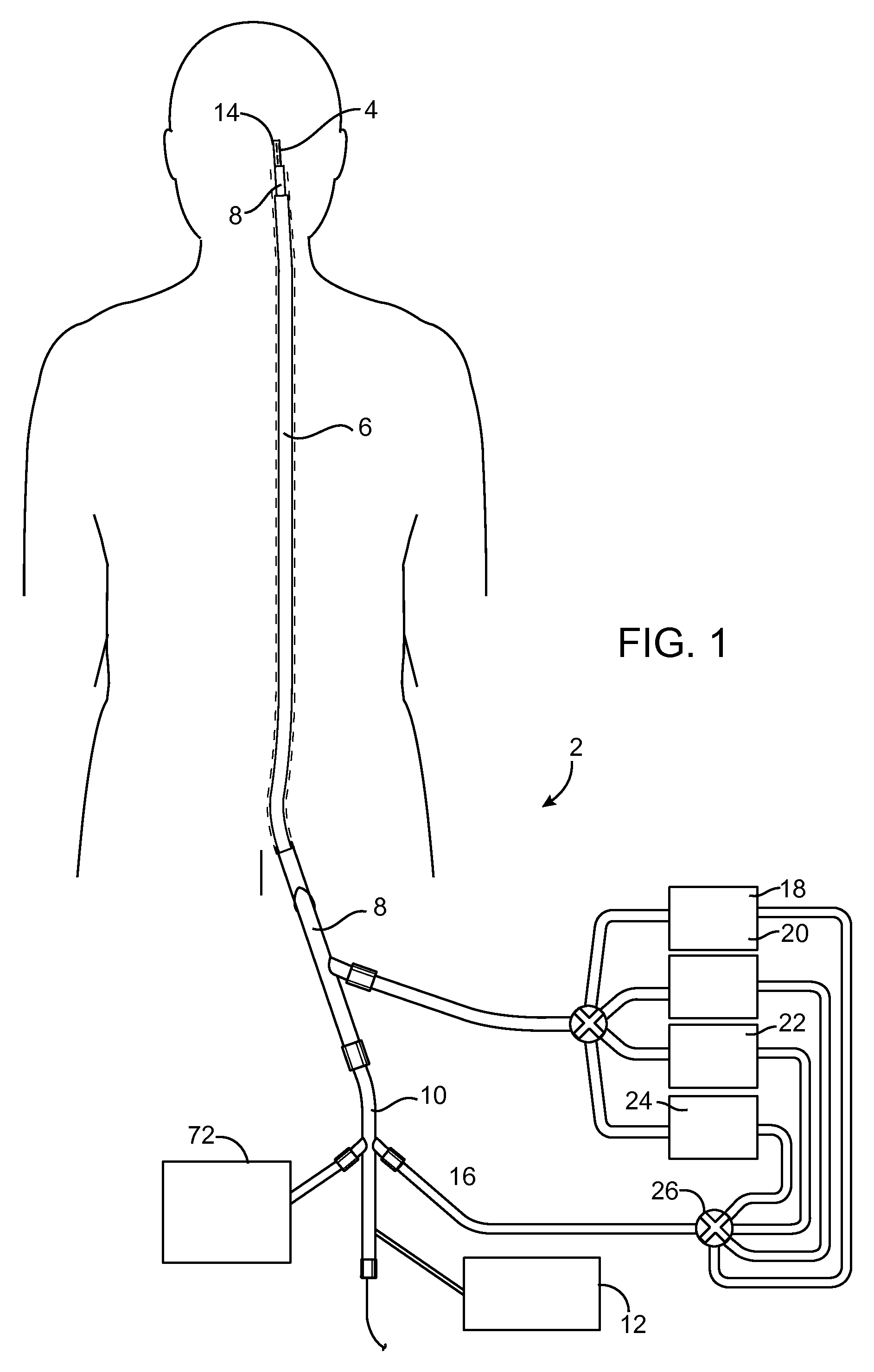 Devices and methods for treating vascular malformations