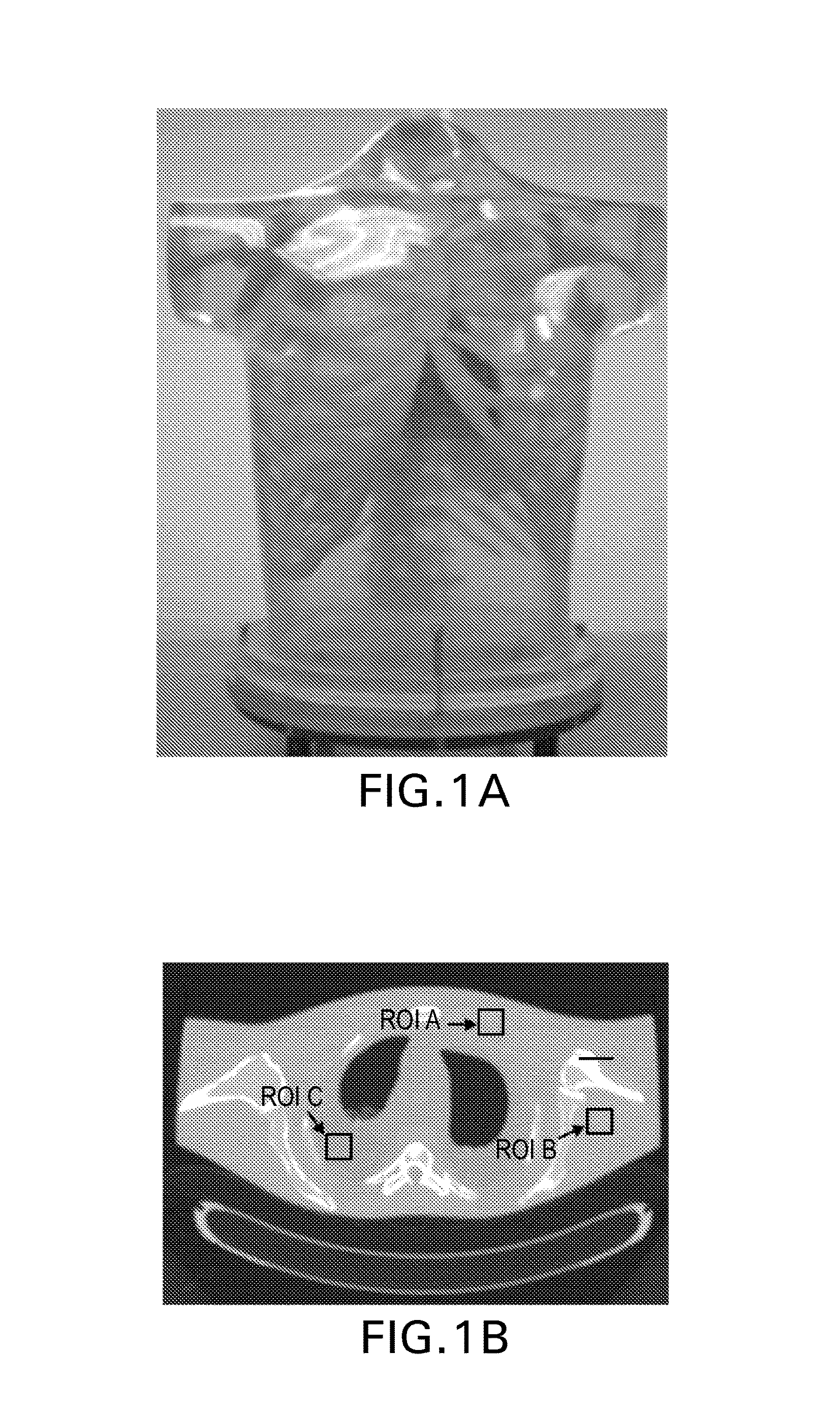 Iterative reconstruction for X-ray computed tomography using prior-image induced nonlocal regularization