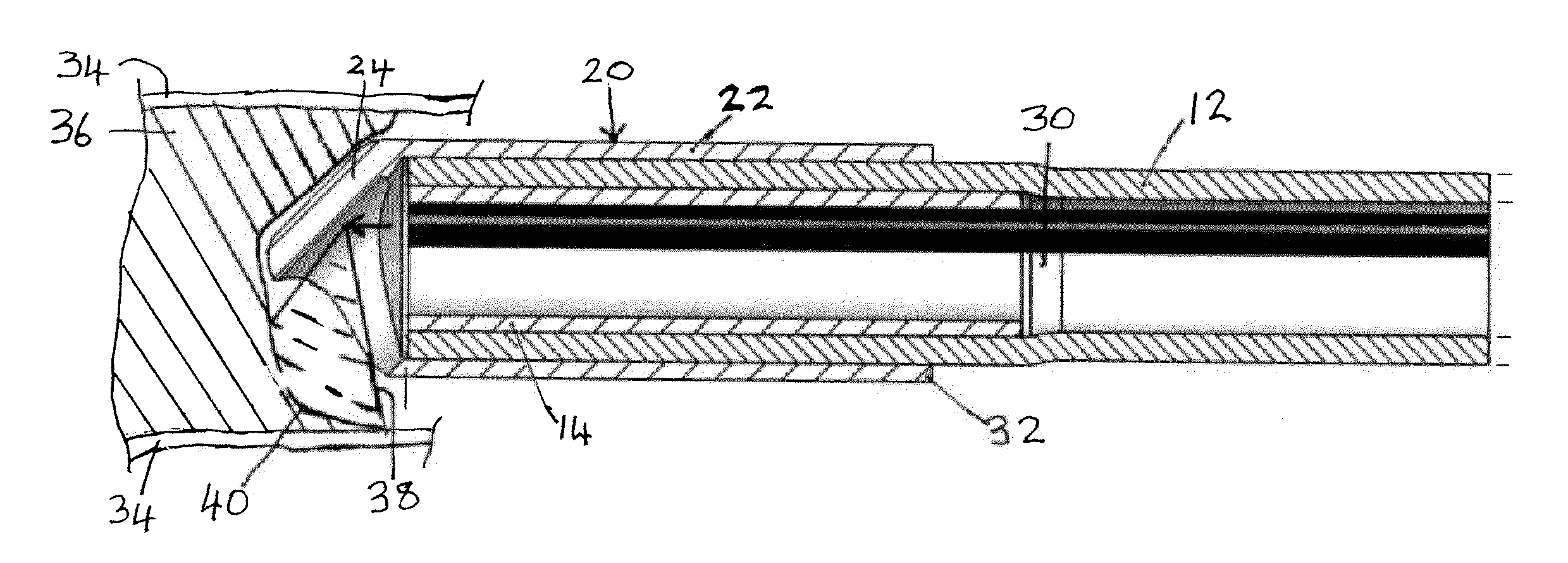 Process and system for treating a vascular occlusion or other endoluminal structure