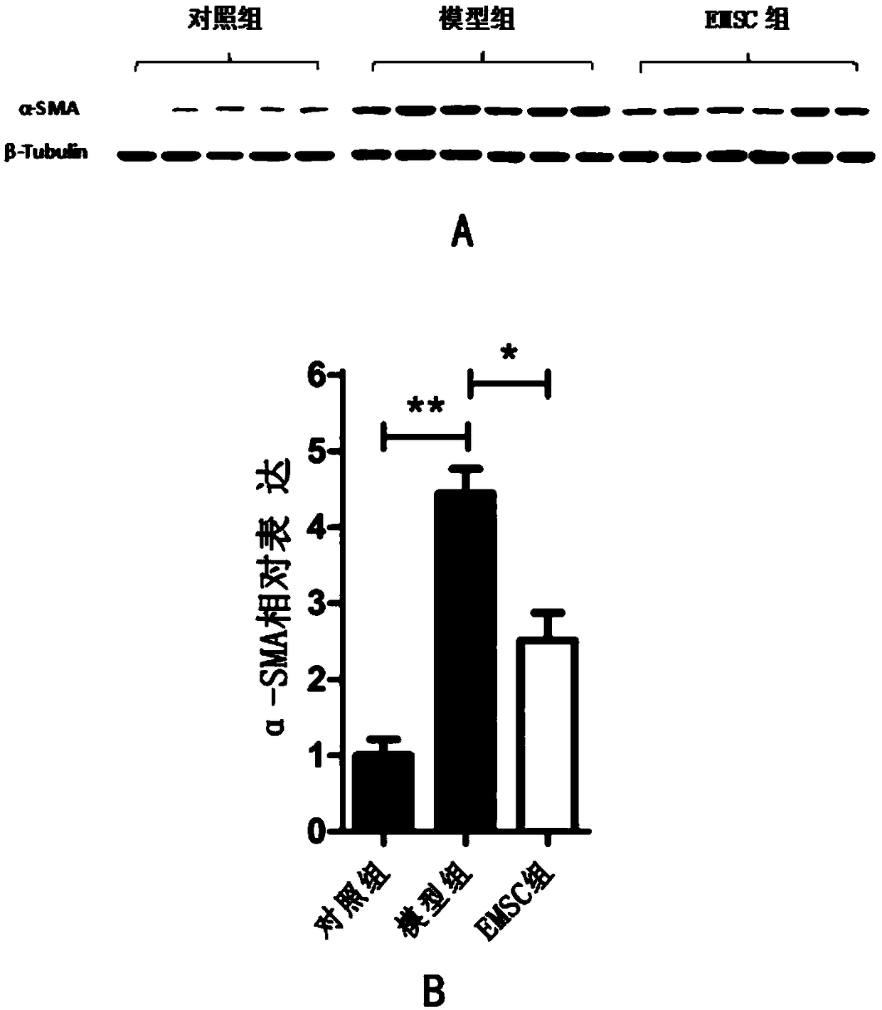 Application of endometrial stem cells in preparation of drugs for preventing or treating pulmonary fibrosis