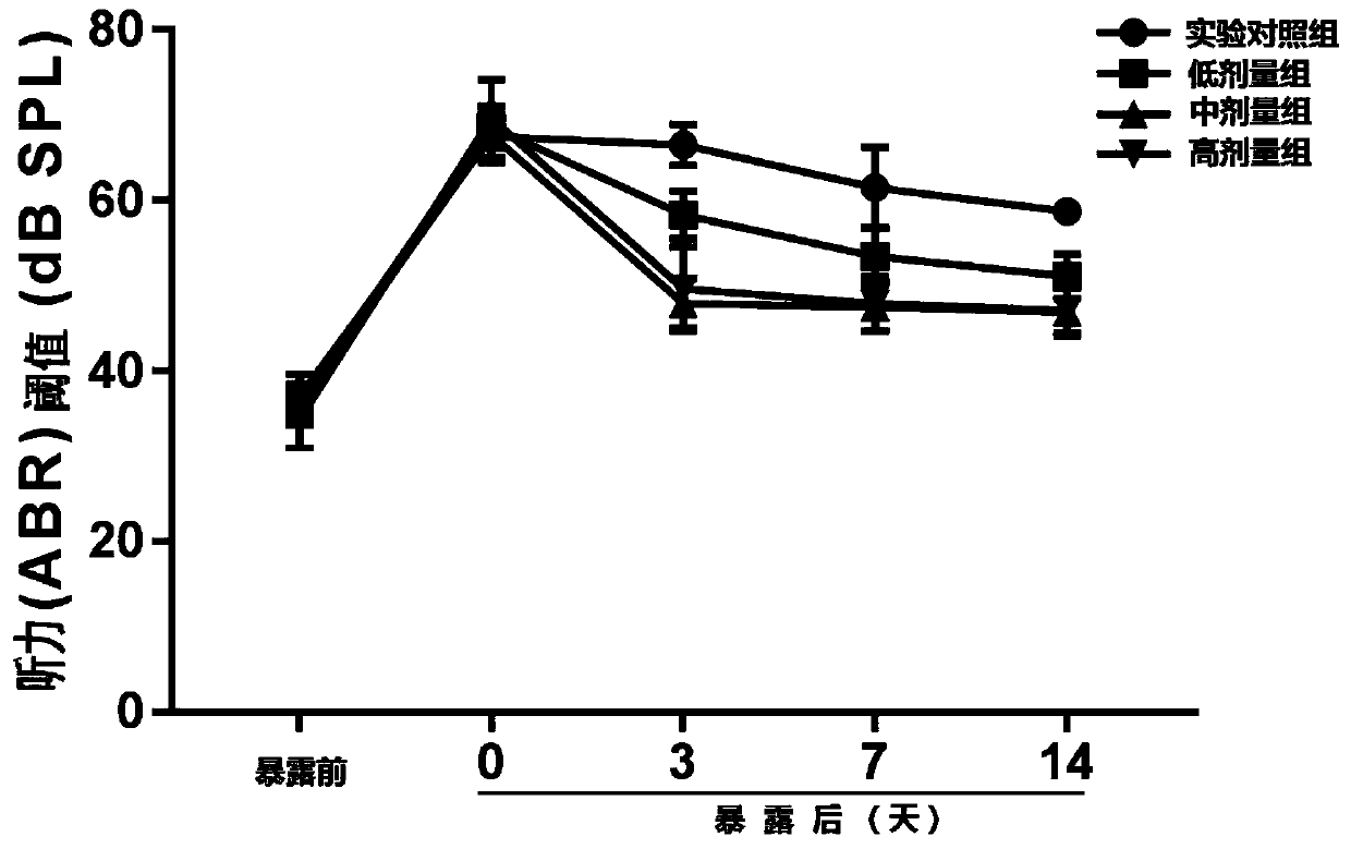 Application of metformin in the preparation of products for the prevention and treatment of noise-induced hearing loss