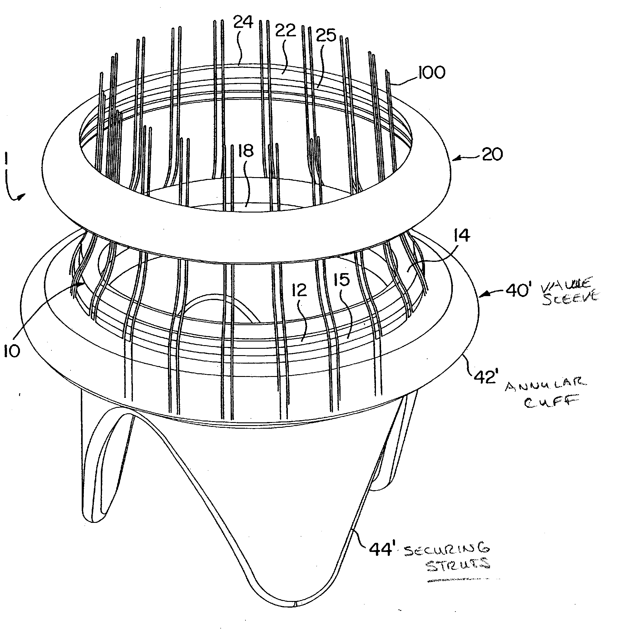 Automatic suture fixation apparatus and method for minimally invasive cardiac surgery