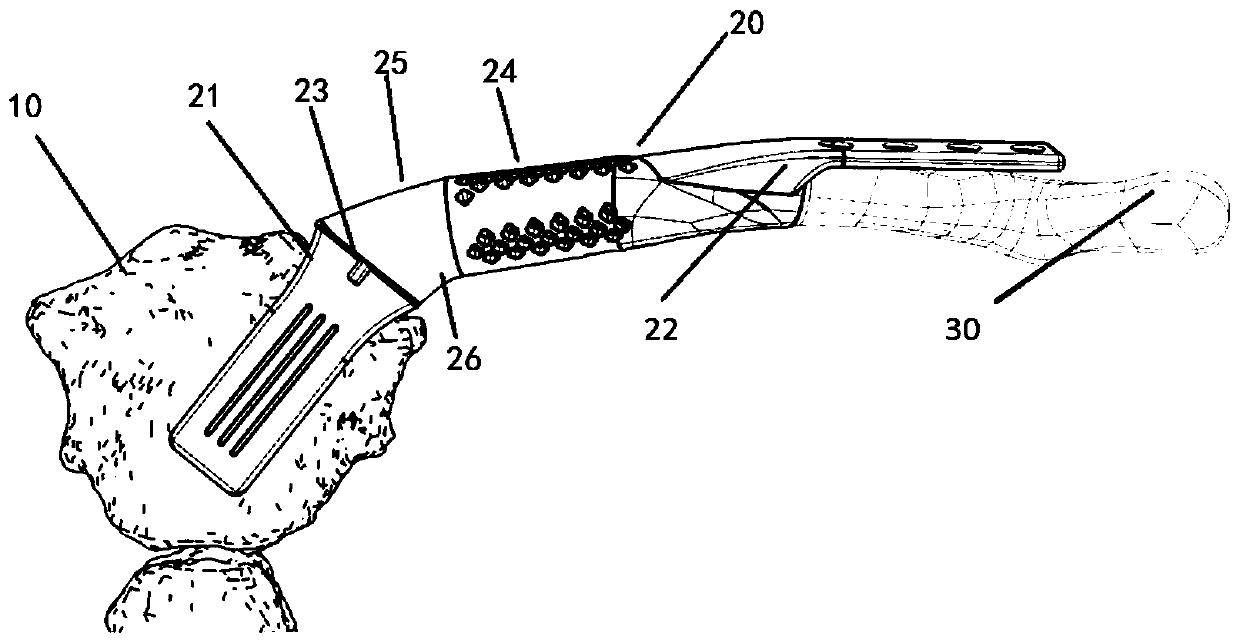 Proximal clavicular anatomical prosthesis and molding method