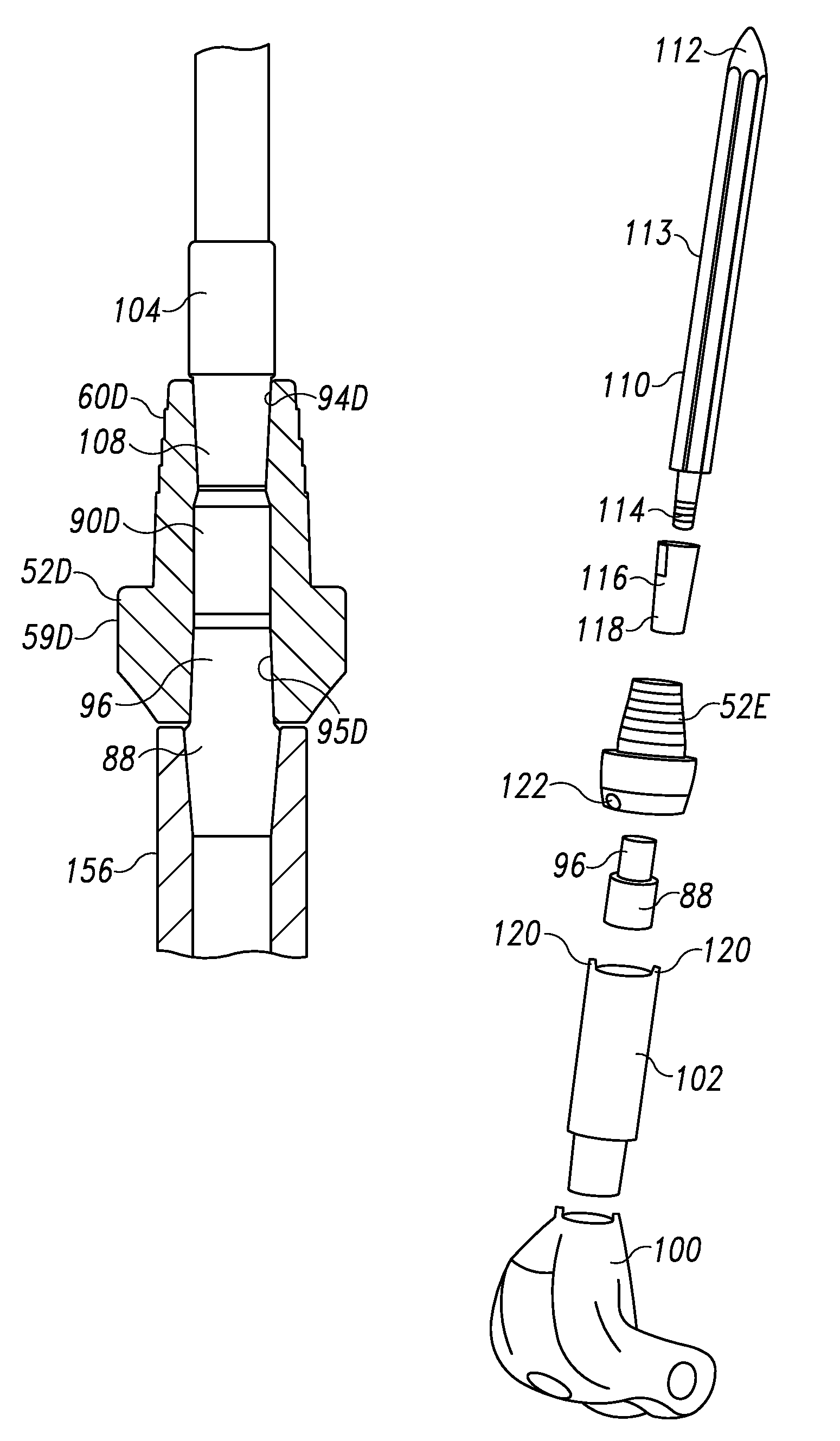 Modular implant system and method with diaphyseal implant and adapter