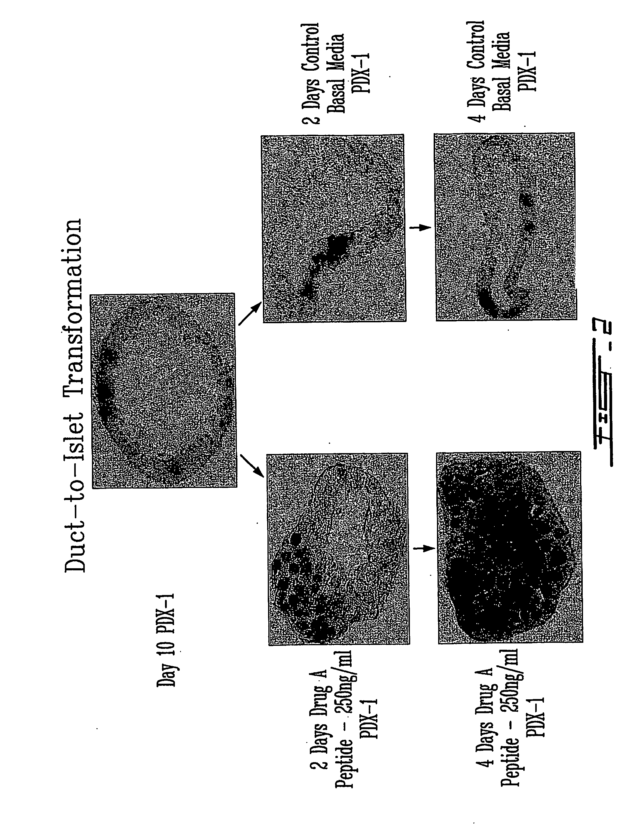 In vitro platform for screening agents inducing islet cell neogenesis