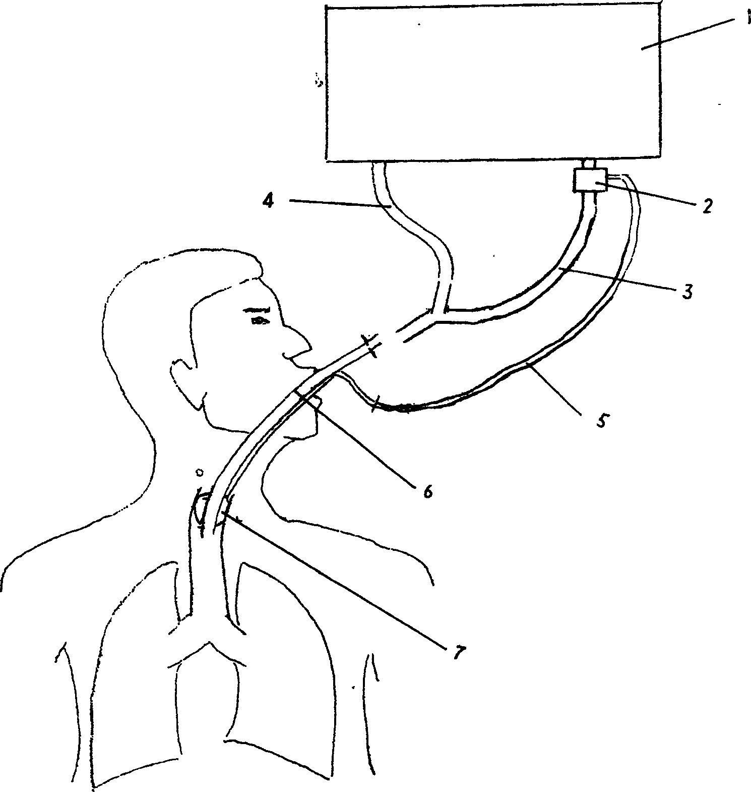 Cannula Automatic aeration unit for air bag of intubation