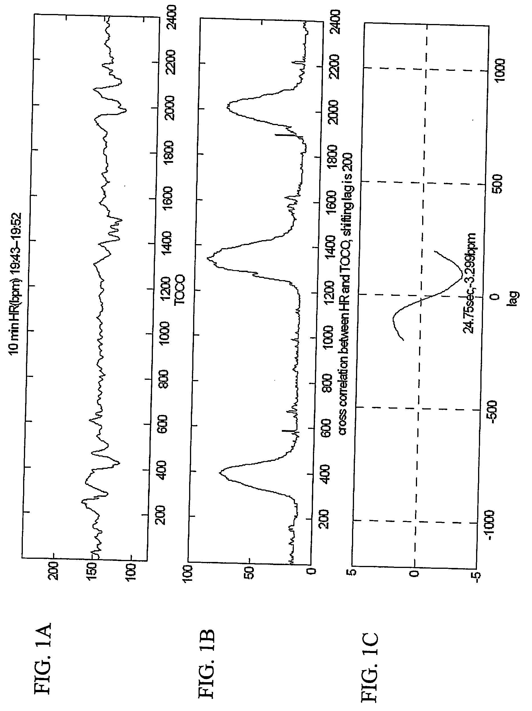 Quantitative fetal heart rate and cardiotocographic monitoring system and related method thereof