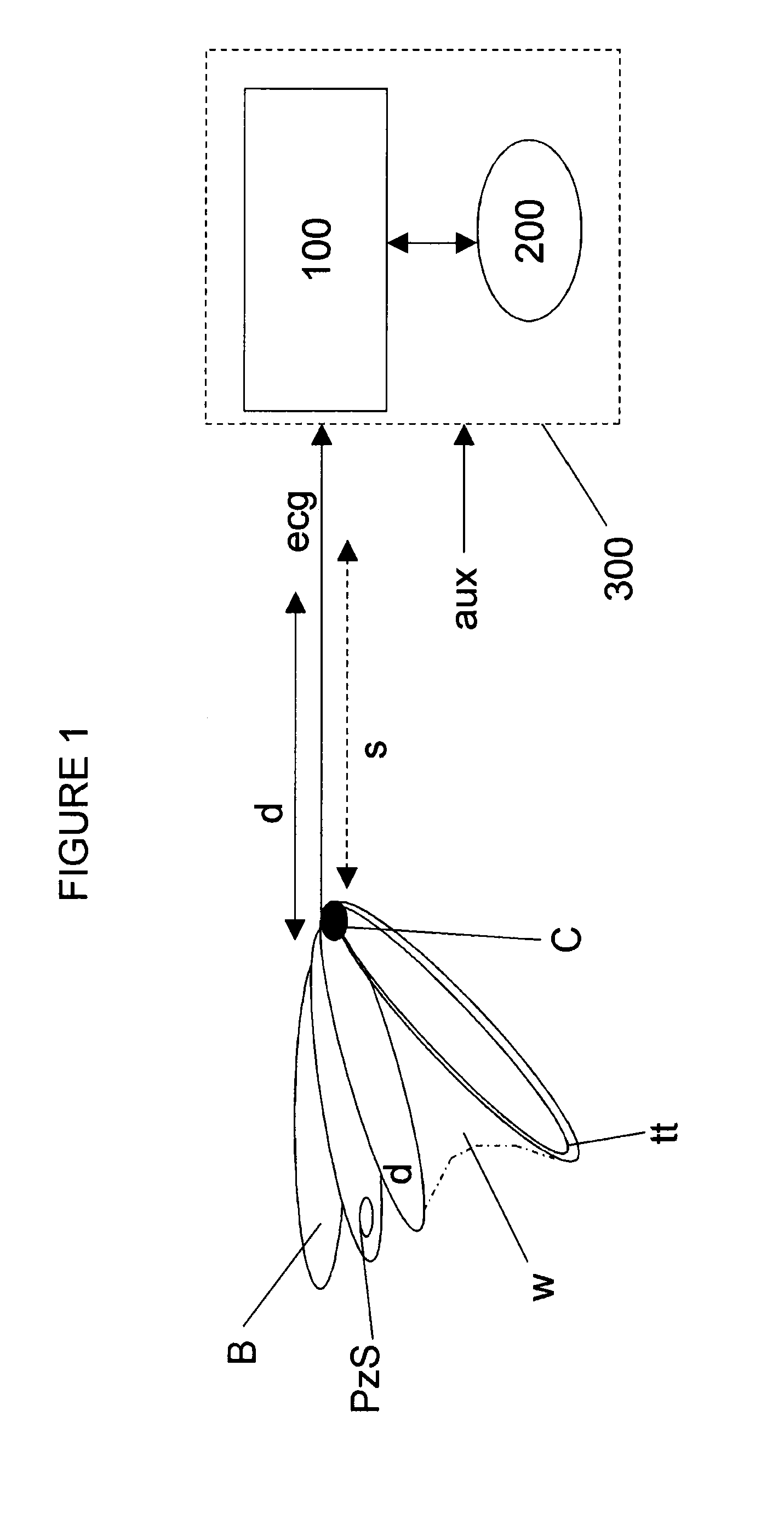 Minimally invasive cardiovascular support system with true haptic coupling