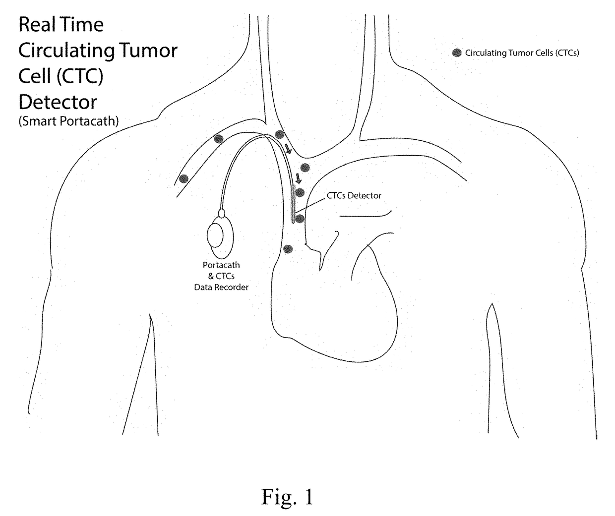 Apparatus for detecting cells in circulating bloodstream