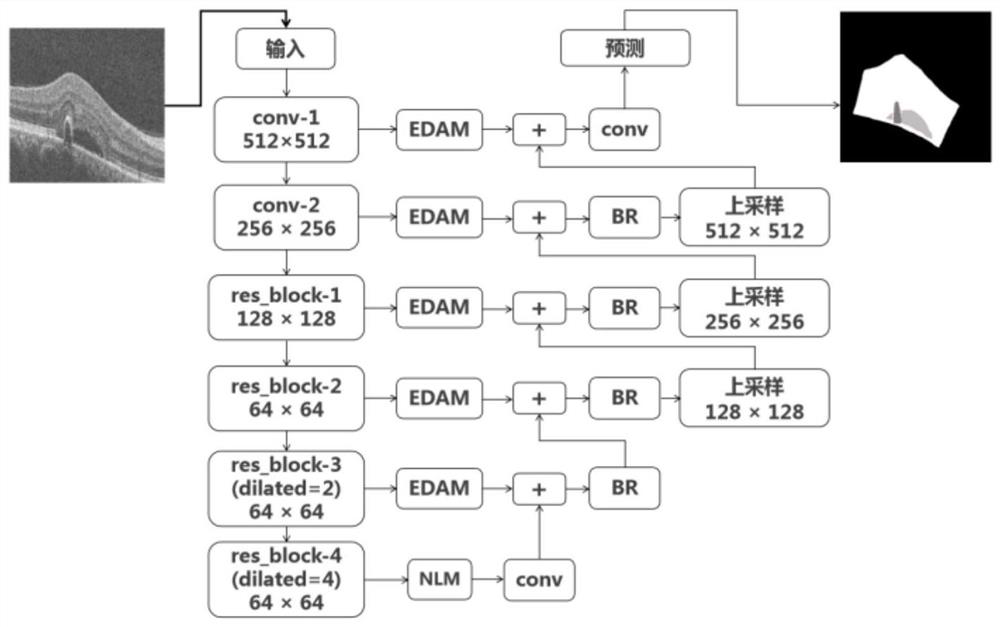 A multi-lesion image segmentation method for retinal macular edema