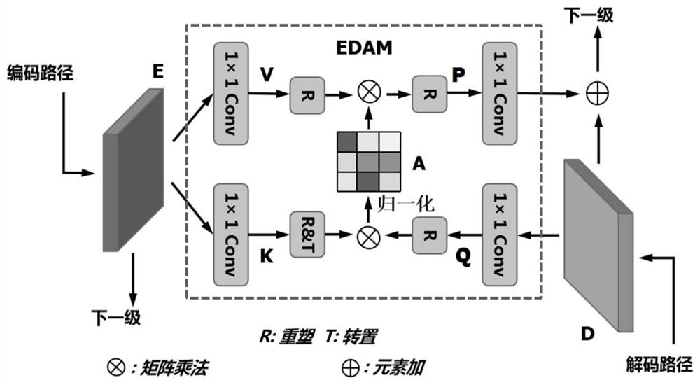 A multi-lesion image segmentation method for retinal macular edema