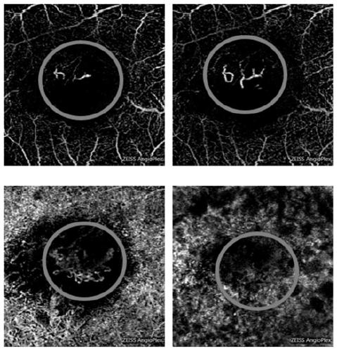 Fundus blood vessel three-dimensional reconstruction method and device and electronic equipment