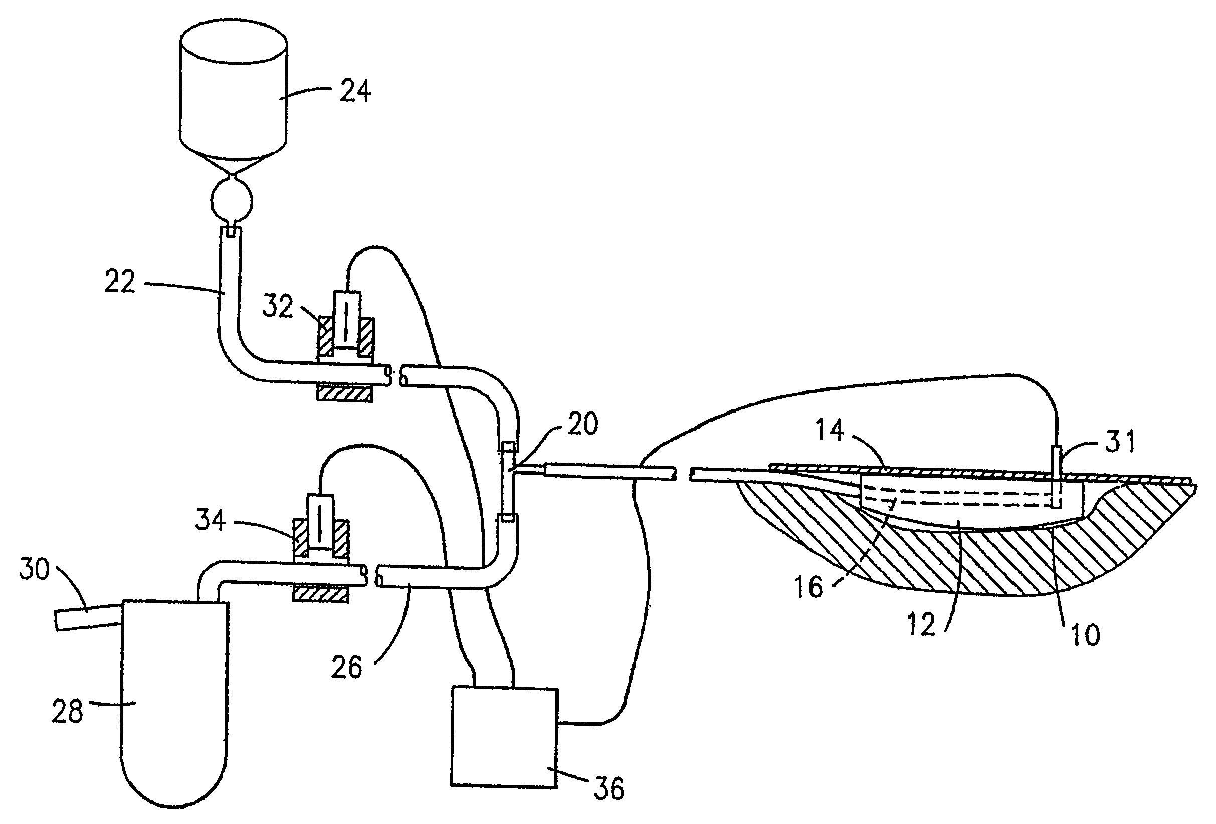 Process and device for application of active substances to a wound surface