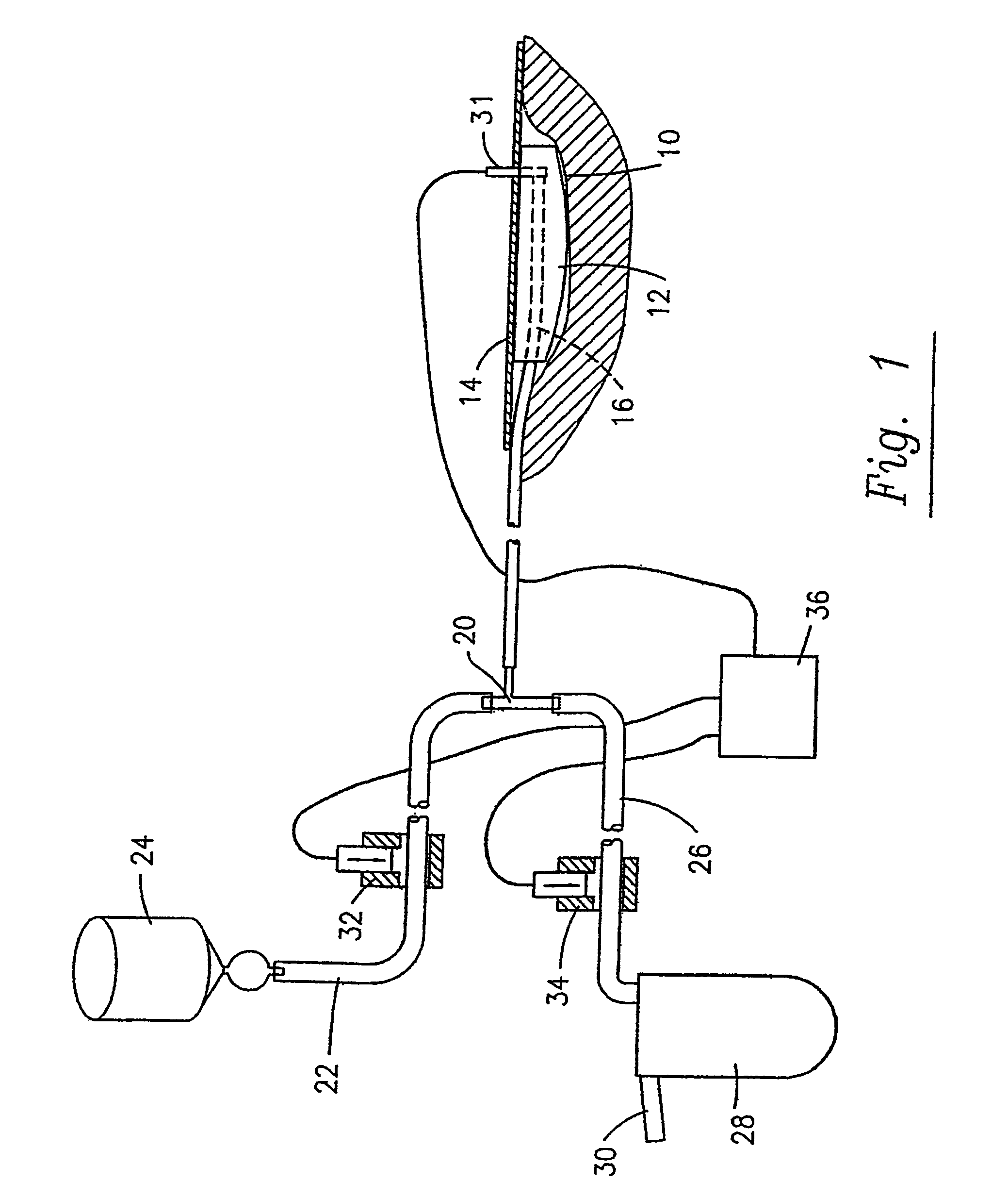 Process and device for application of active substances to a wound surface