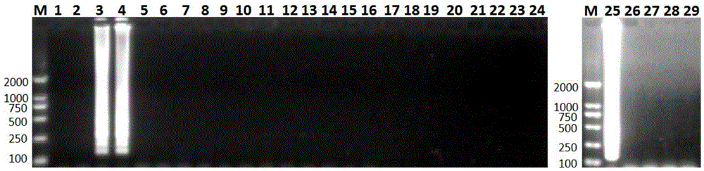 Application of Aspergillus fumigatus annexin anxC4 gene (anxC4 gene)