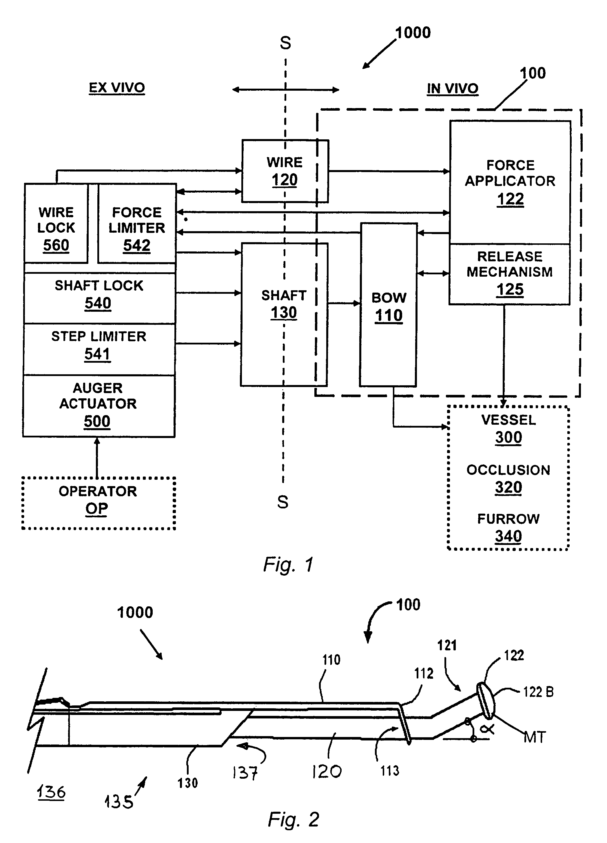 Blood vessel occlusion auger