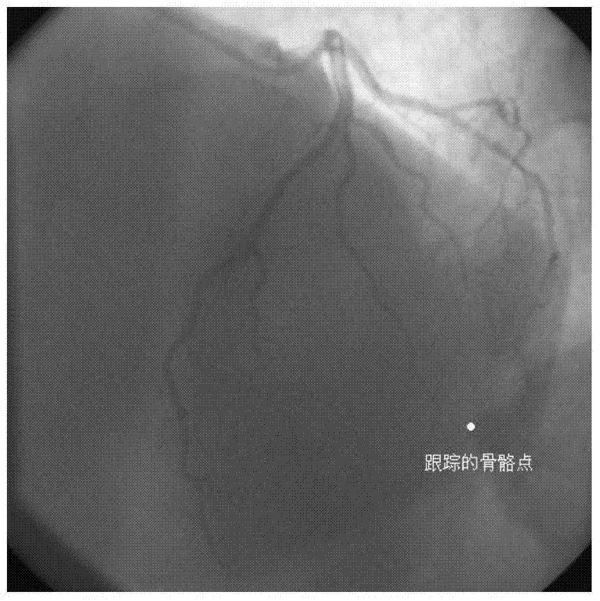 Iterative method for extracting motion parameters of angiography images guided by multi-parameter model