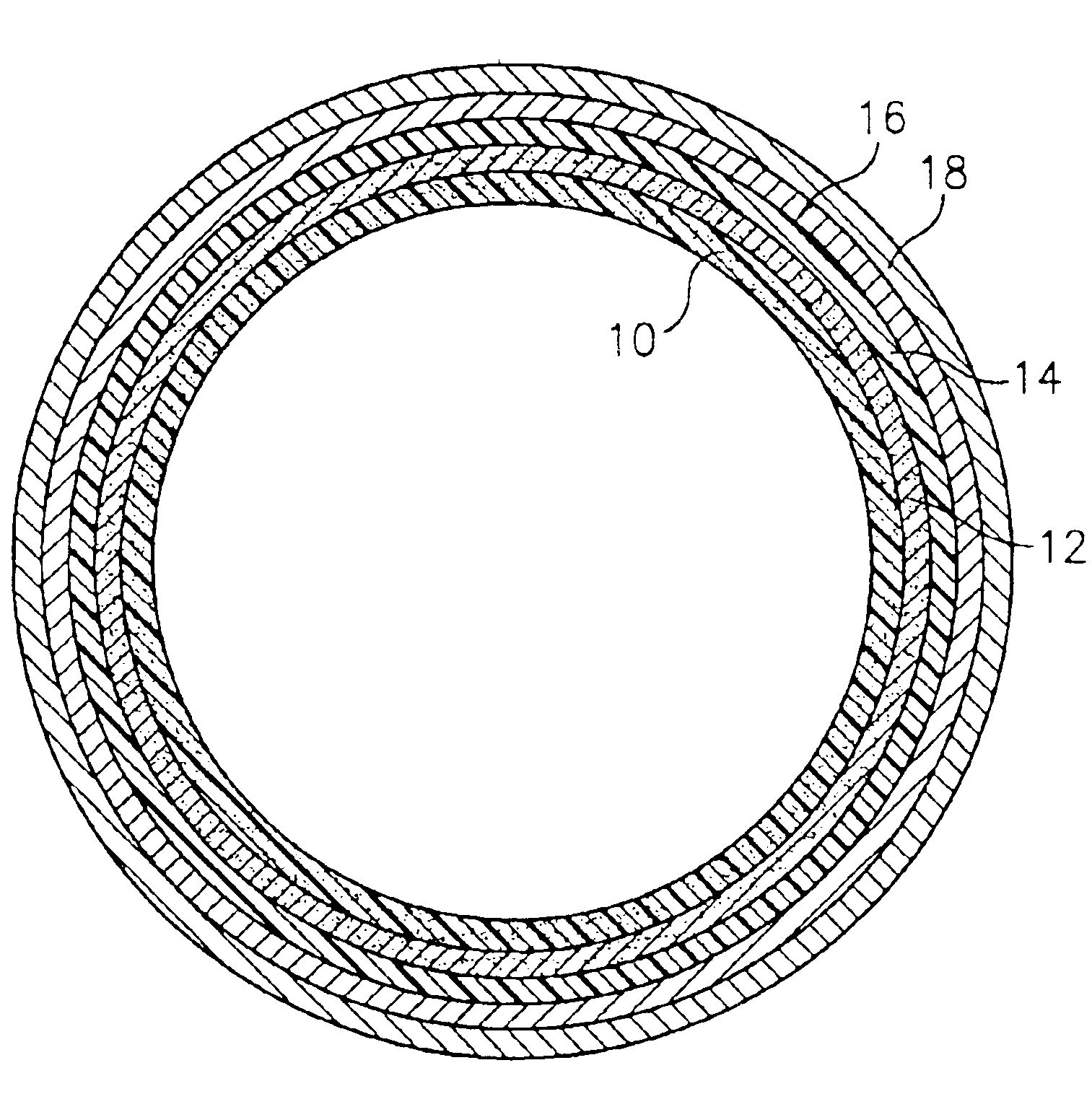 Printing sleeve with an integrated printing surface