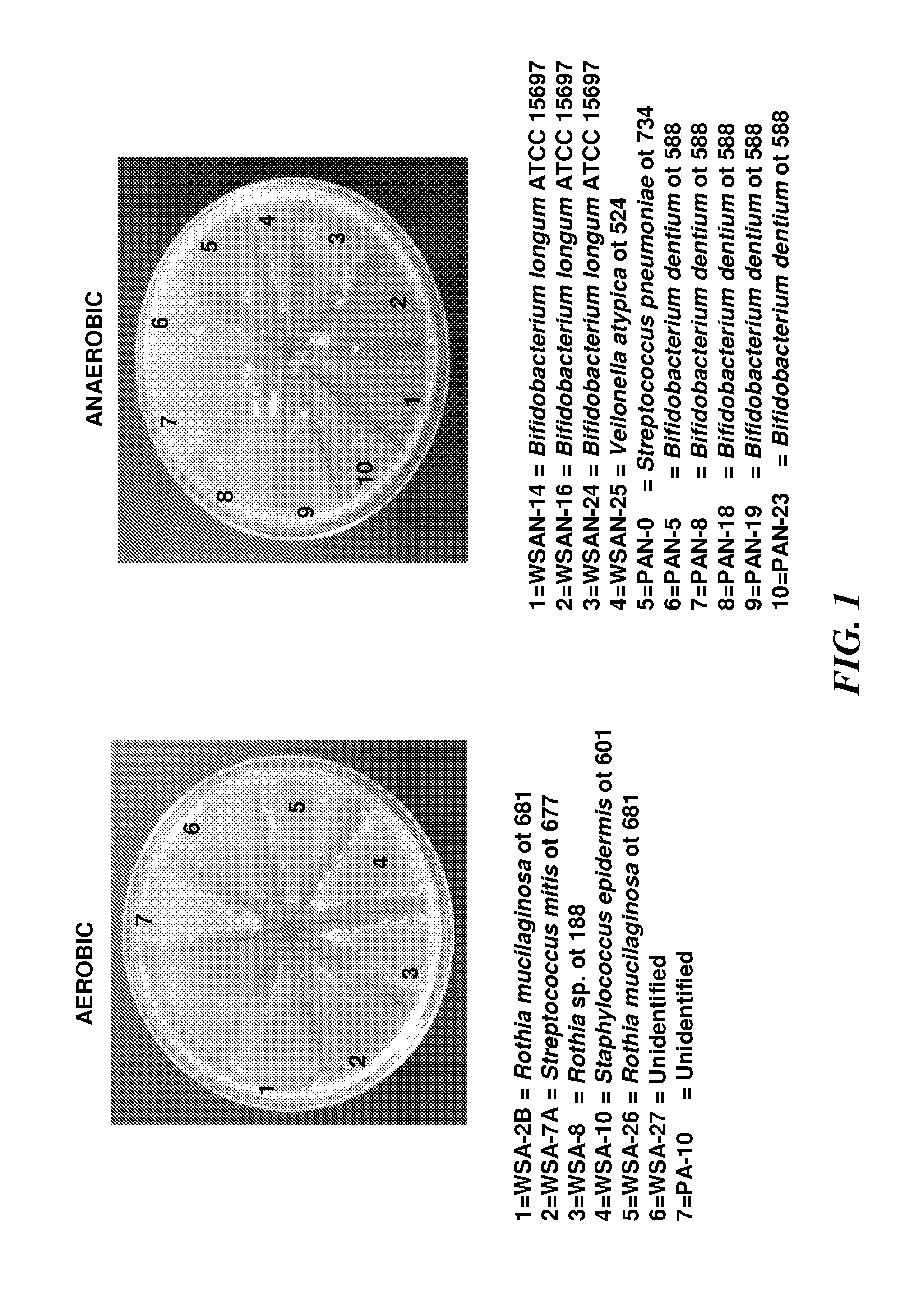 Rothia species glutamine endopeptidases and use thereof