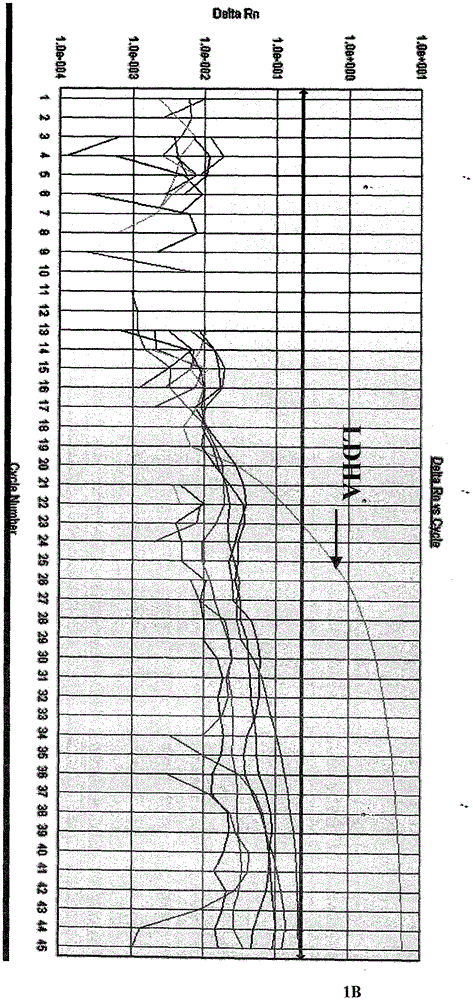 Method and kit for simultaneously detecting human type A and type B respiratory syncytial viruses and human metapneumoviruses