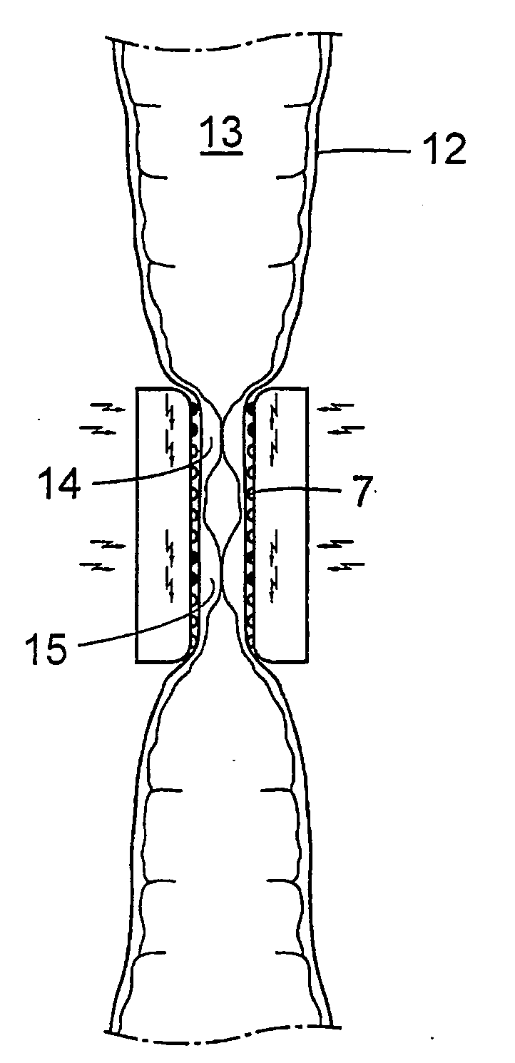 Method for the treatment of gallstones