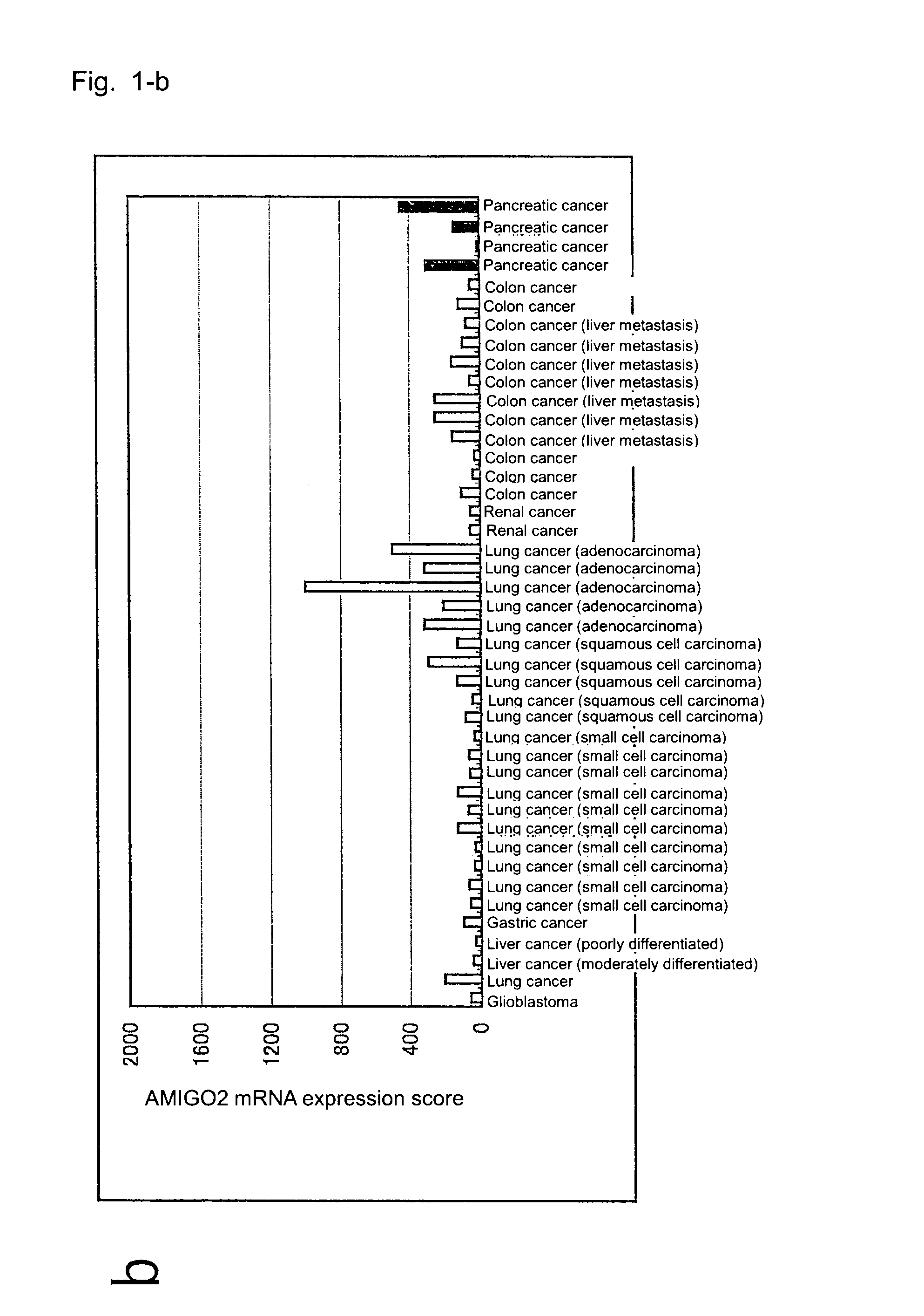 Diagnostic agent and therapeutic agent for pancreatic cancer