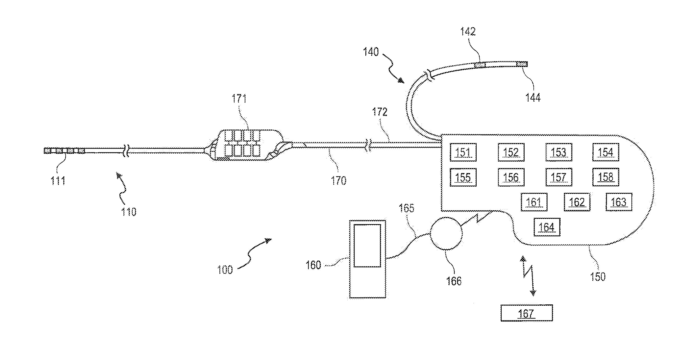 Neurostimulation method and system to treat apnea