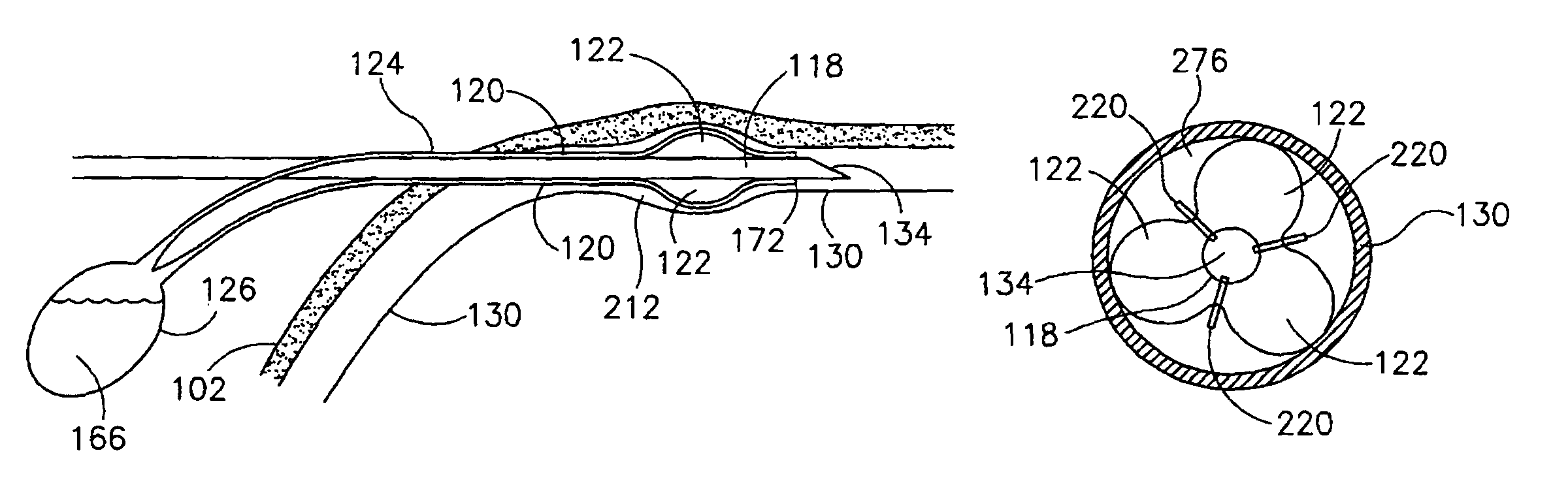 Vascular coupling device