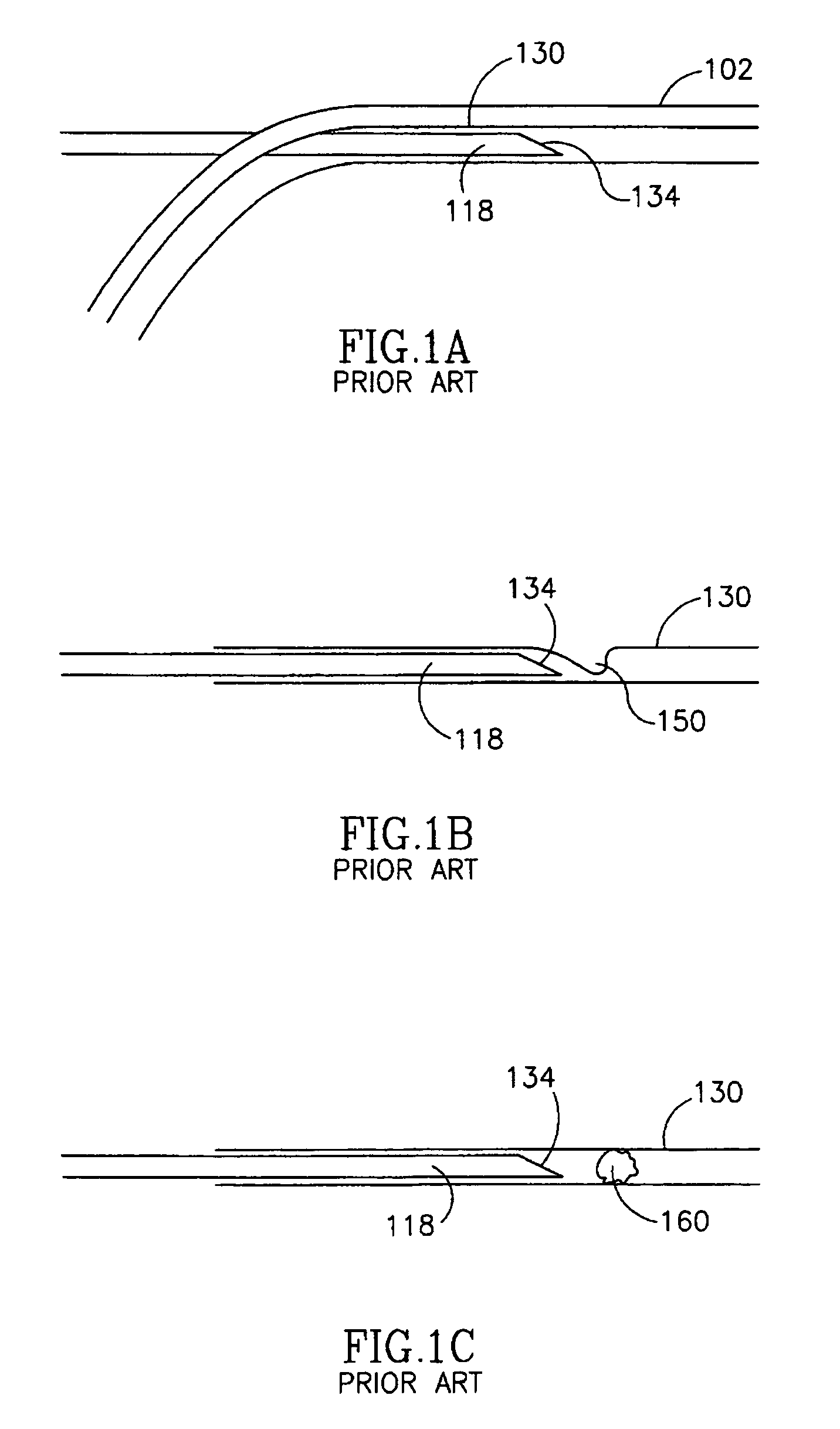 Vascular coupling device