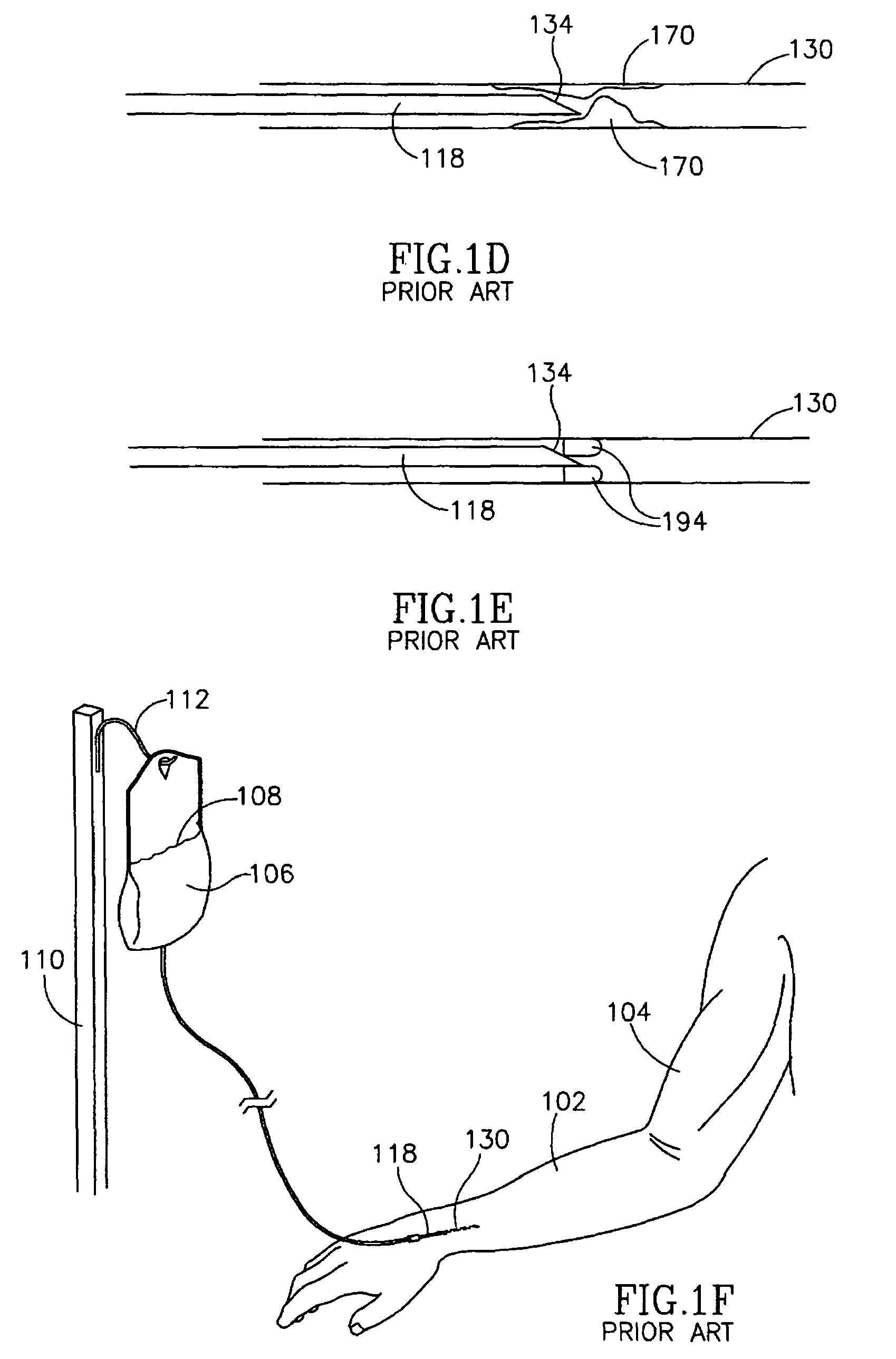 Vascular coupling device