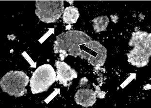 Pancreatic island freezing protective agent and using method thereof