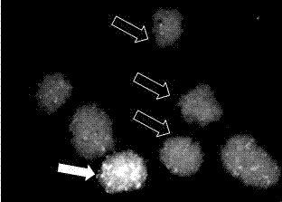 Pancreatic island freezing protective agent and using method thereof