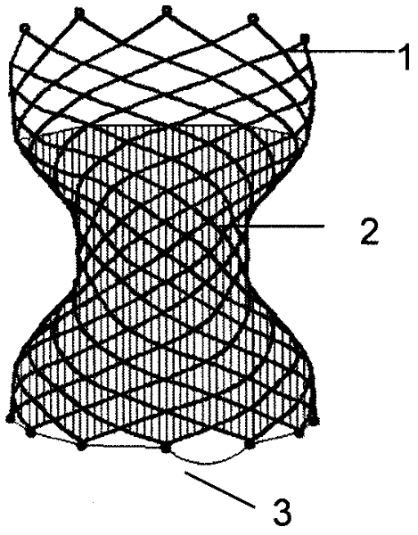 Recyclable interventional stent for constricting blood vessels