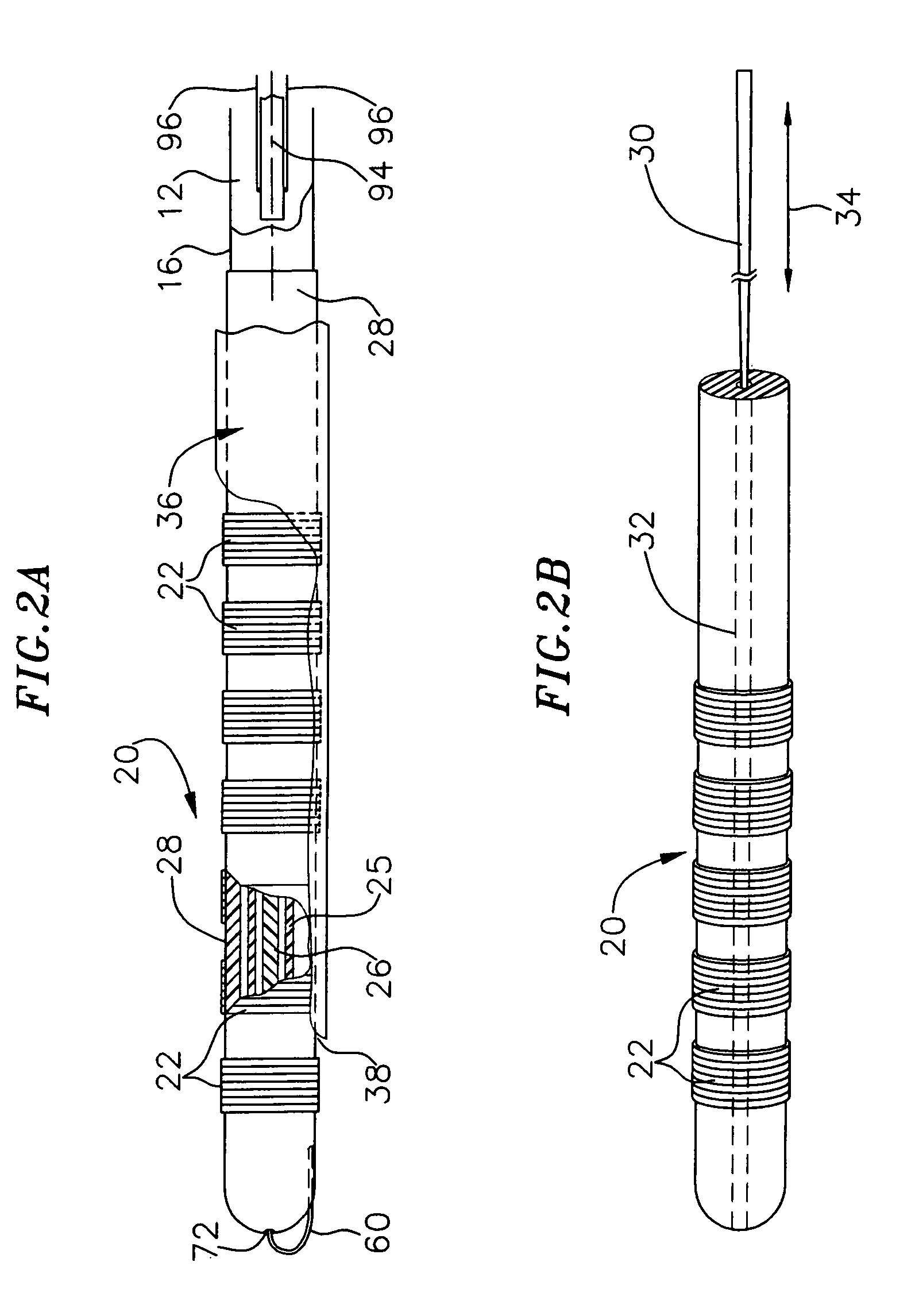 Catheter distal assembly with pull wires