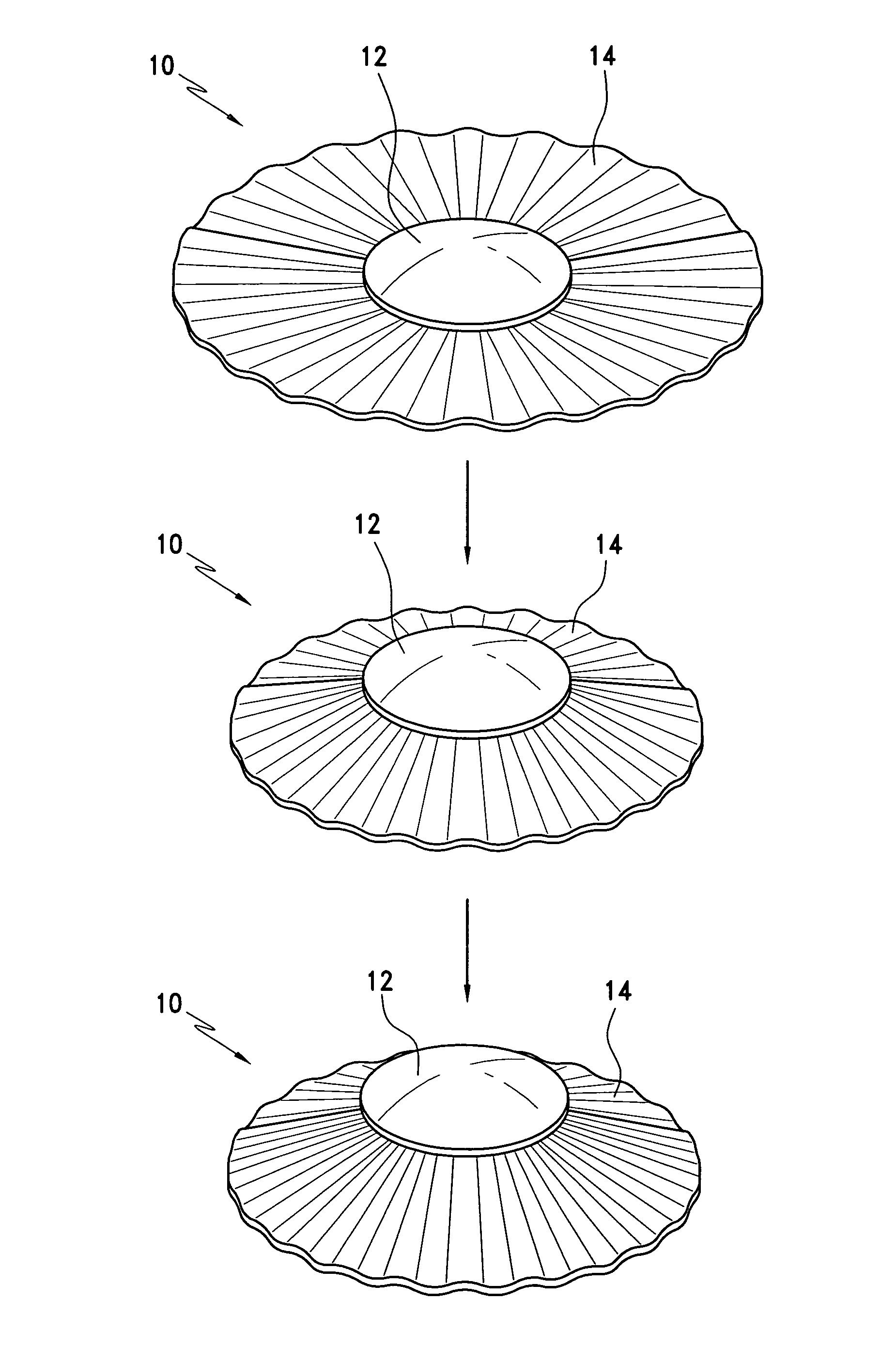 Umbrella-shaped accommodating artificial ocular lens (AAOL) device