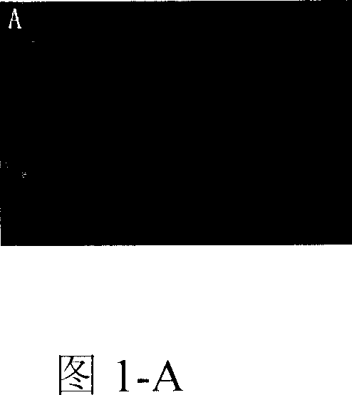 Scutellarein derivative, its preparing process and application