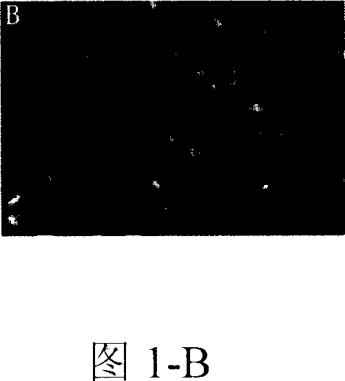 Scutellarein derivative, its preparing process and application