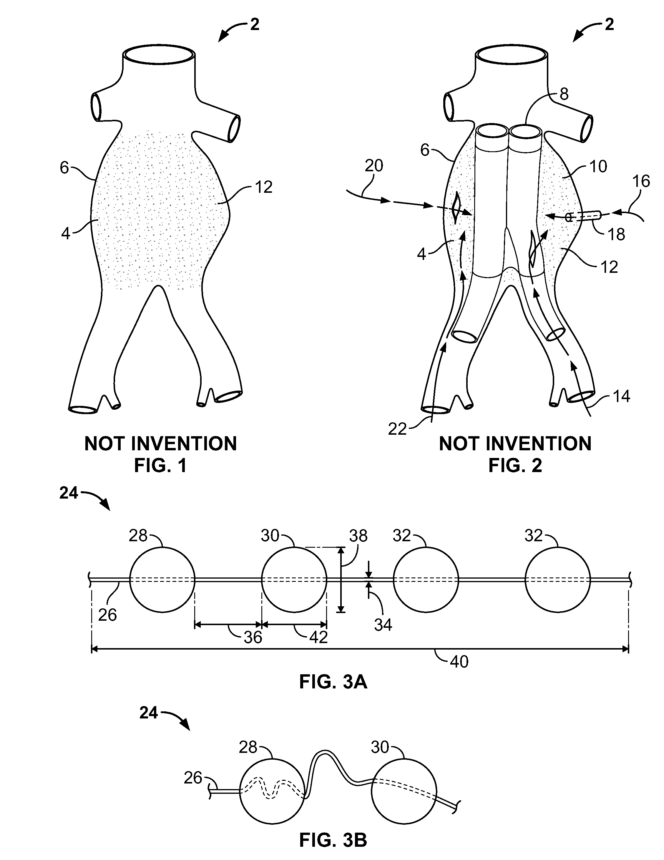 Embolization device and a method of using the same