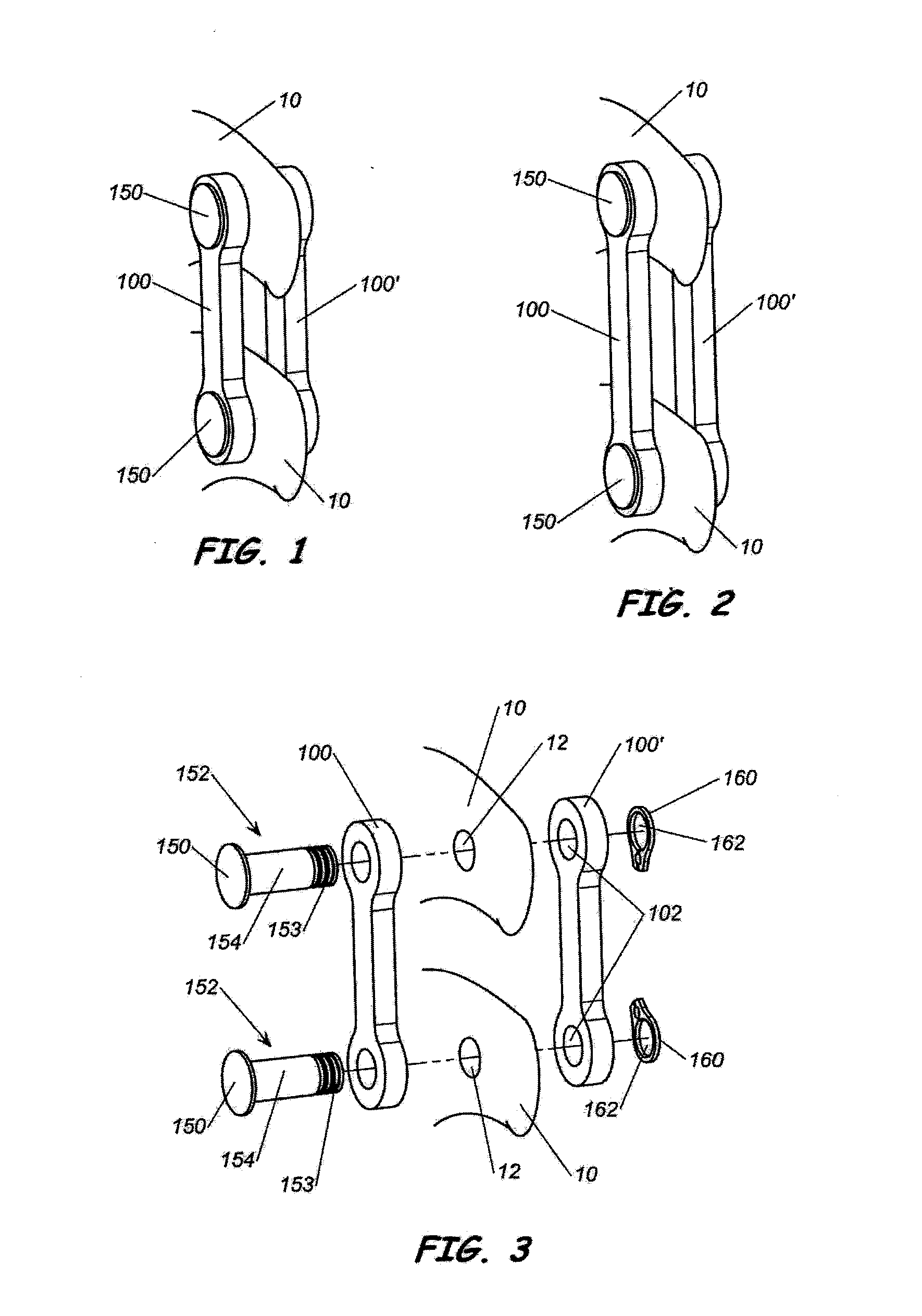 Intersegmental motion preservation system for use in the spine and methods for use thereof