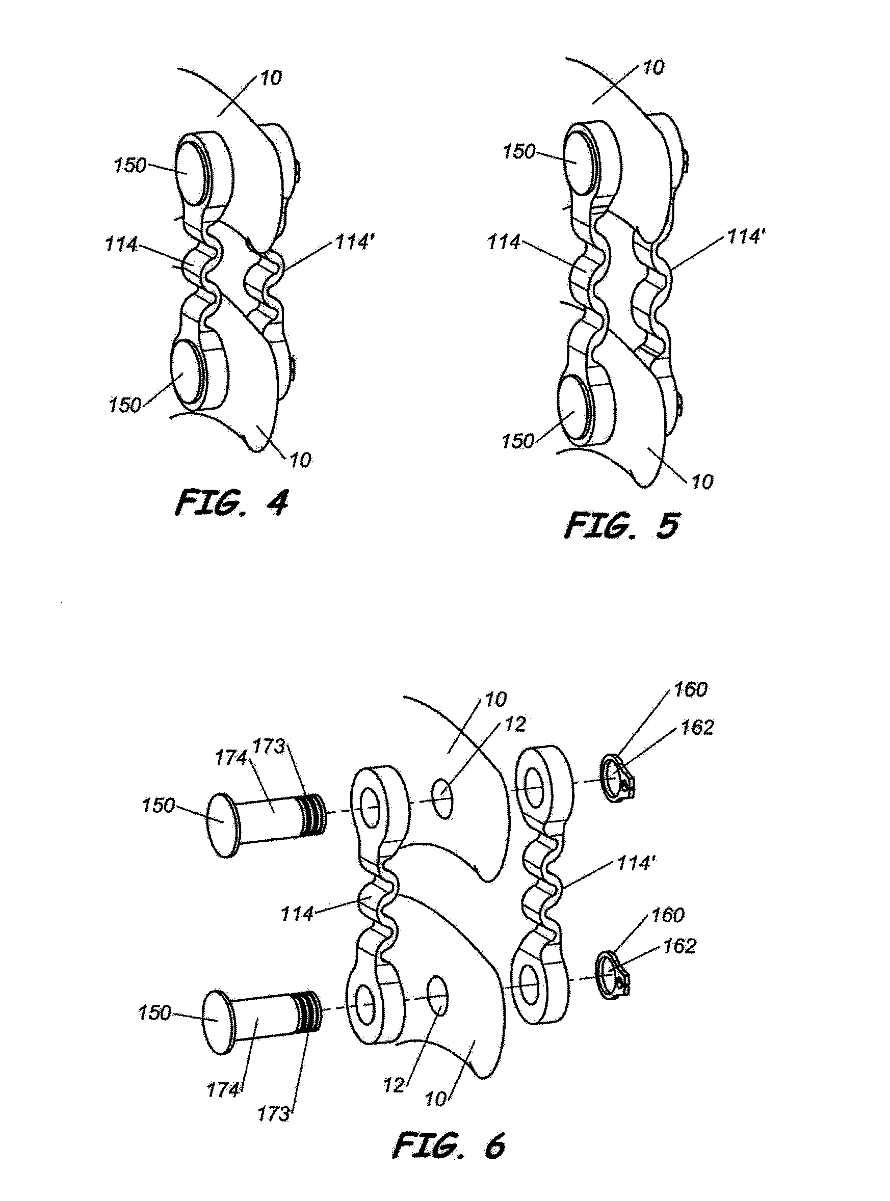 Intersegmental motion preservation system for use in the spine and methods for use thereof