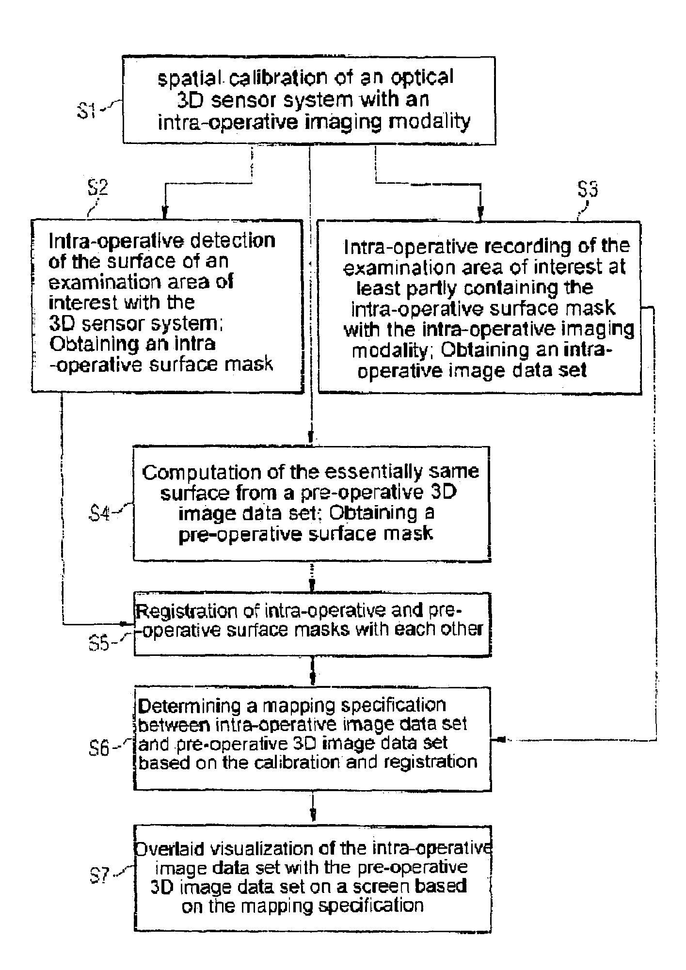 Registering intra-operative image data sets with pre-operative 3D image data sets on the basis of optical surface extraction