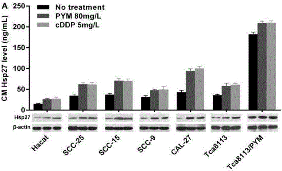 Application of Hsp27 in tolerance diagnosis and treatment for tongue cancer chemotherapy