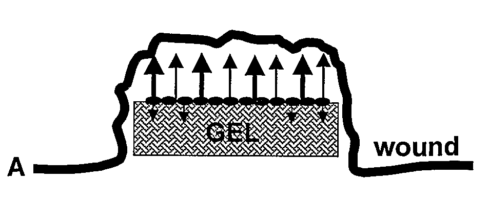 Pharmaceutical Composition For Topical Use In Form Of Xerogels Or Films And Methods For Production