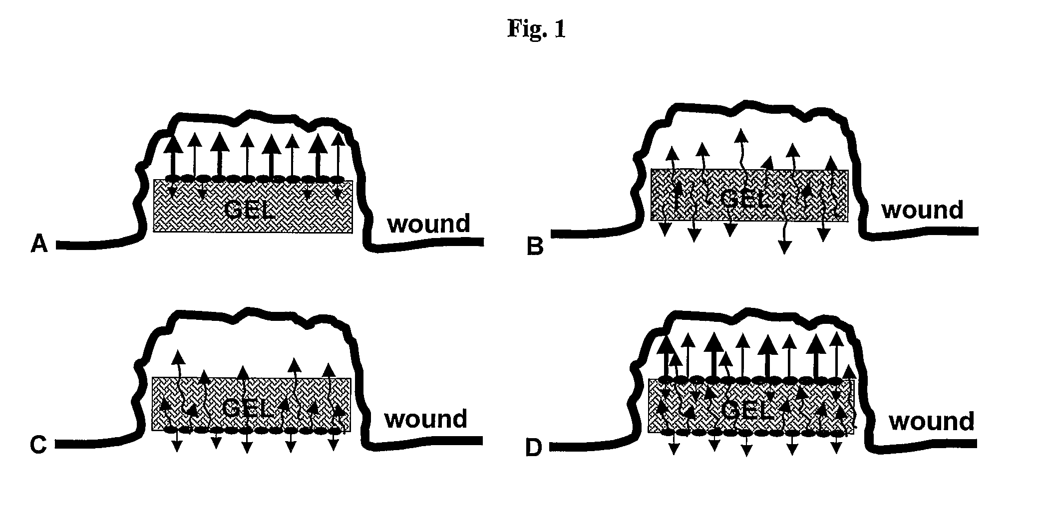 Pharmaceutical Composition For Topical Use In Form Of Xerogels Or Films And Methods For Production