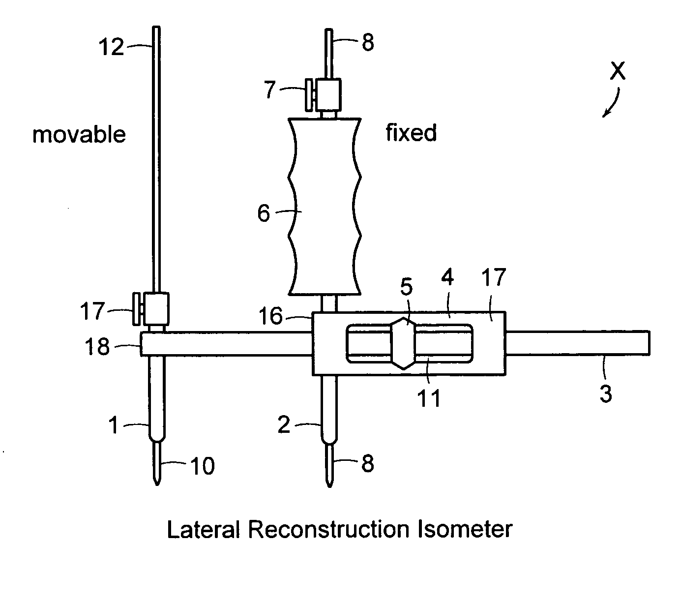 Surgical device for a anterolateral reconstruction