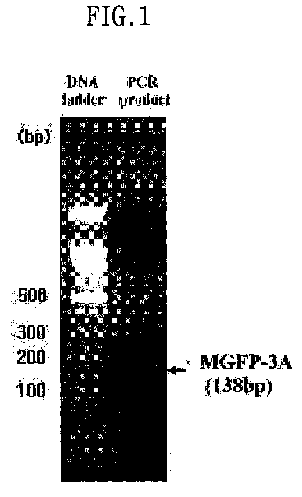 Mussel bioadhesive